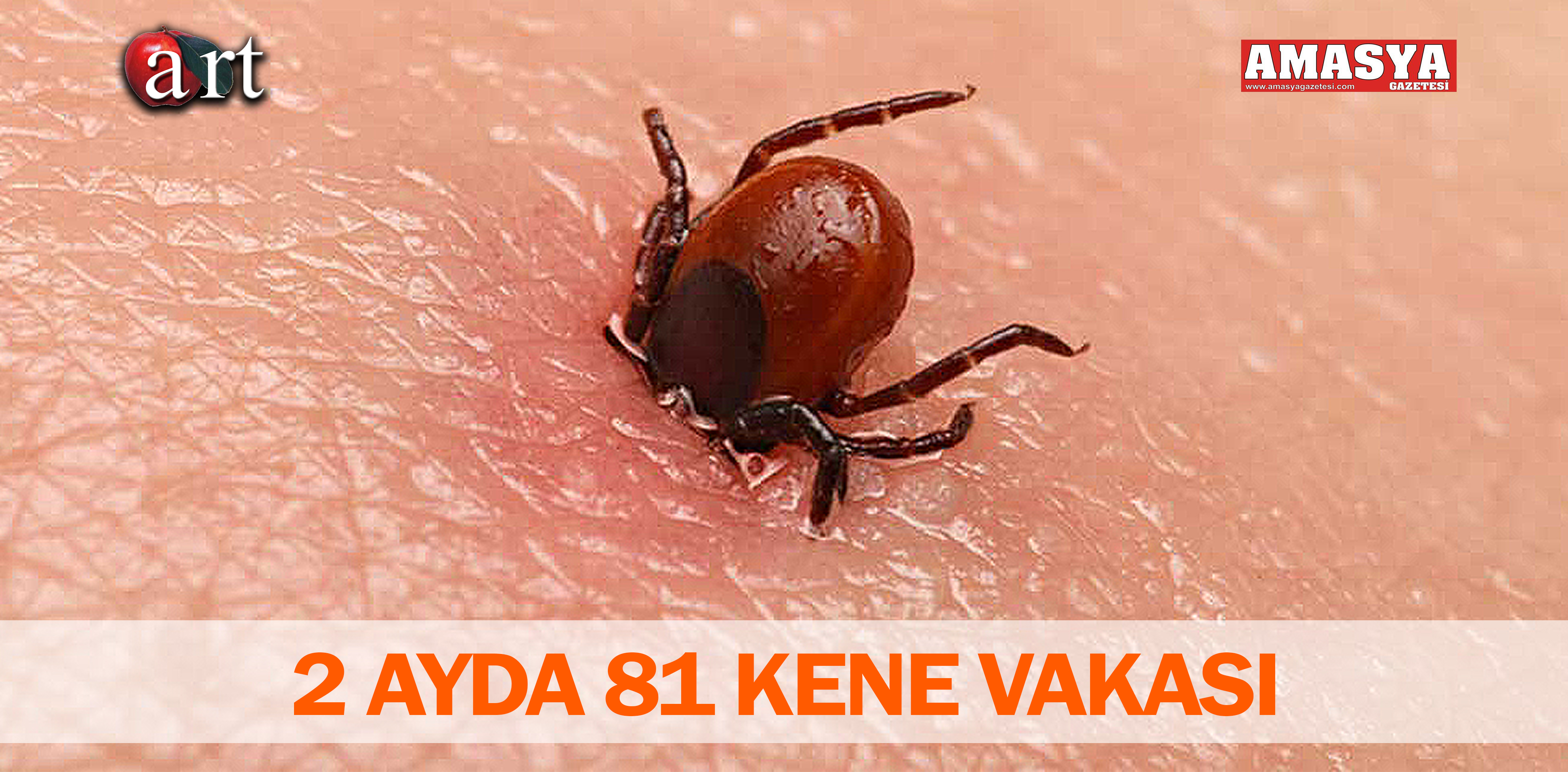 2 AYDA 81 KENE VAKASI