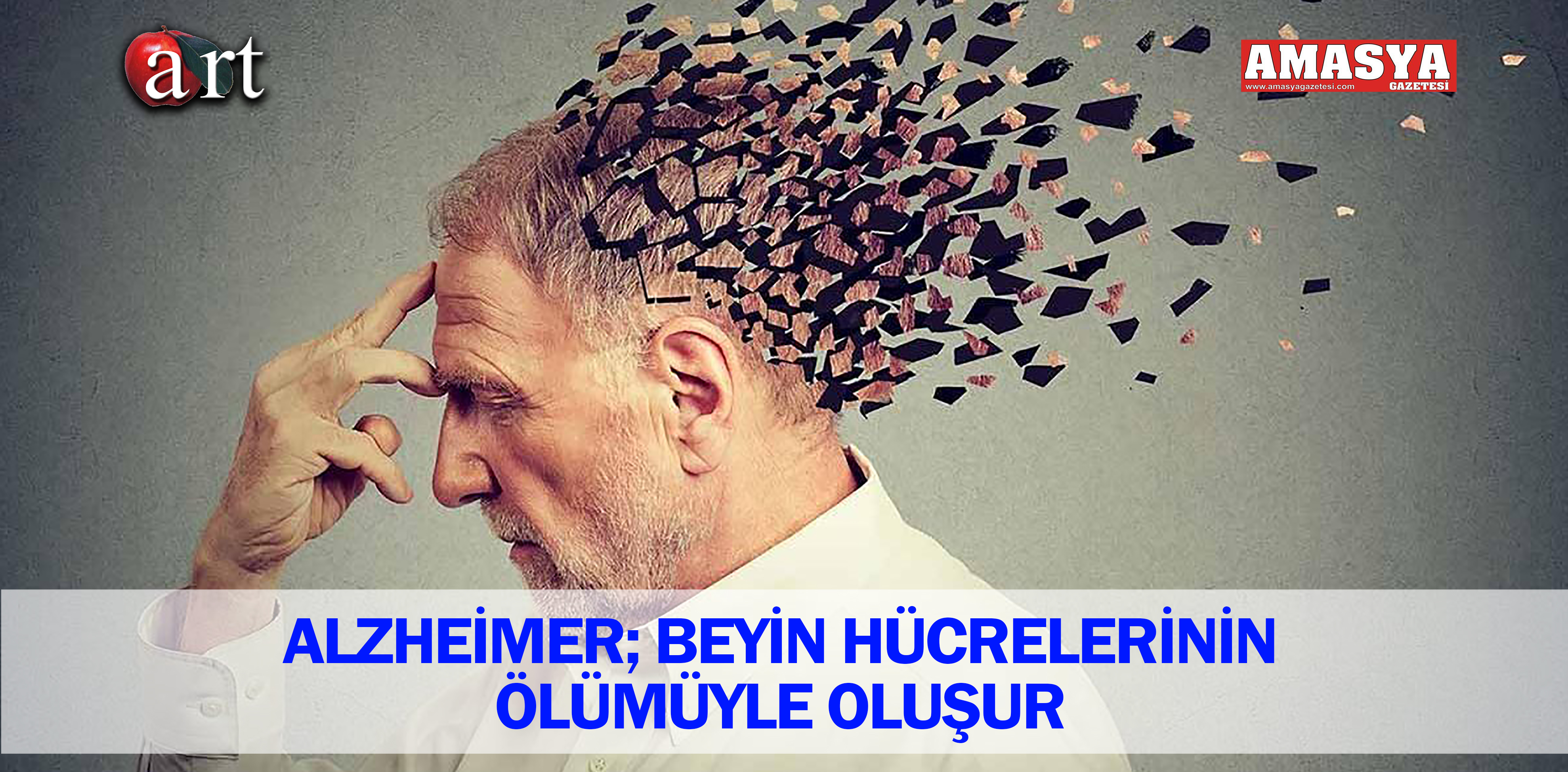 ALZHEİMER; BEYİN HÜCRELERİNİN ÖLÜMÜYLE OLUŞUR